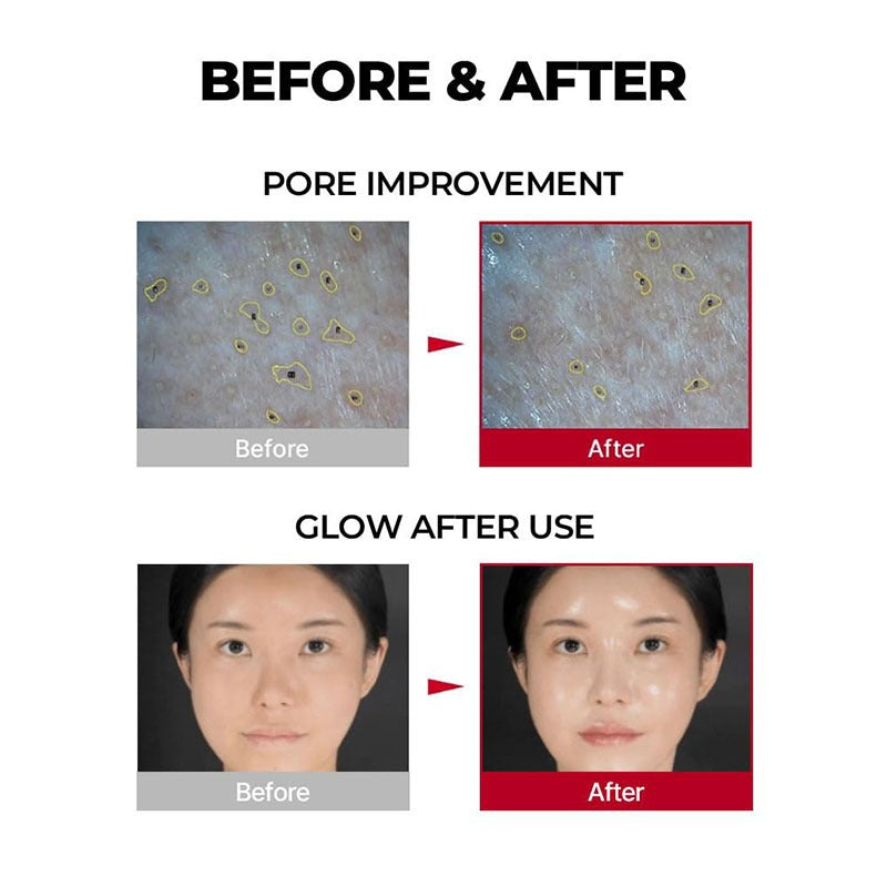 Radiant Red Collagen Face Mask (Best For Skin Glow)