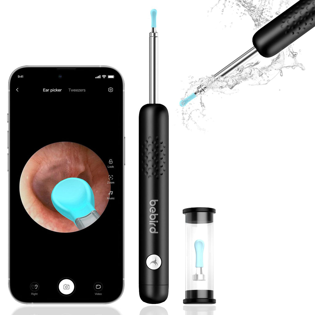 SmartView Ear Wax Removal HD Otoscope (Best For Ear Cleaning)